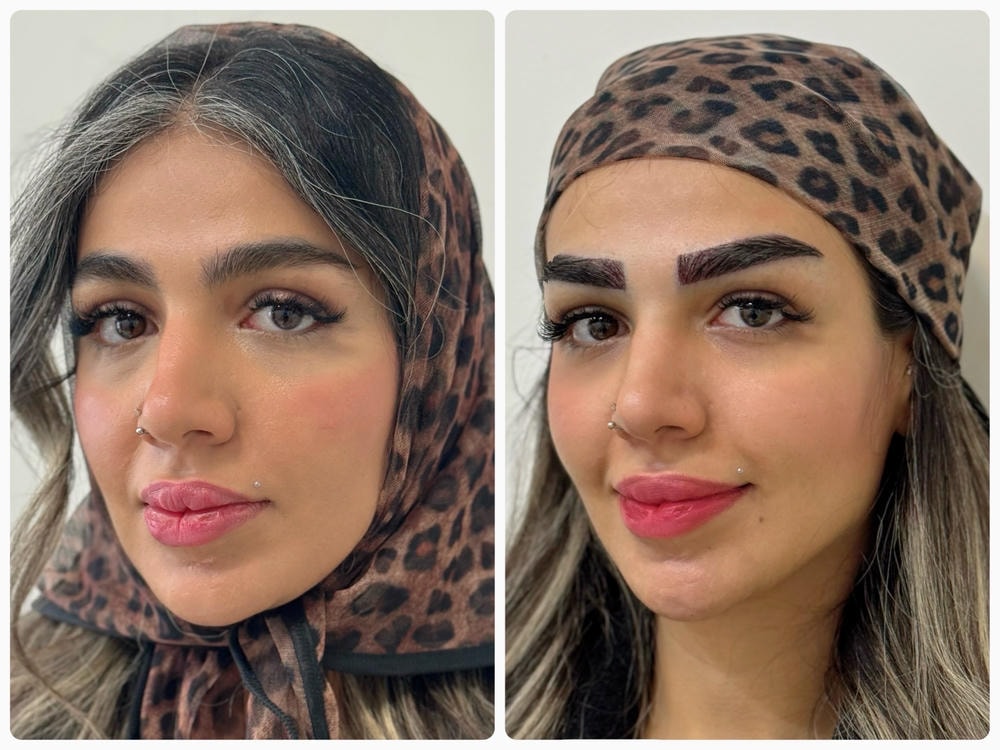 نتیجه پاکسازی پوست